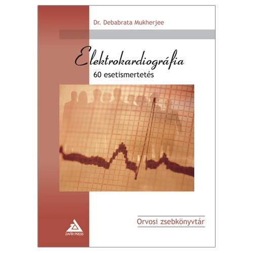 Elektrokardiográfia - 60 esetismertetés - Dr. Debabrata Mukherjee | 